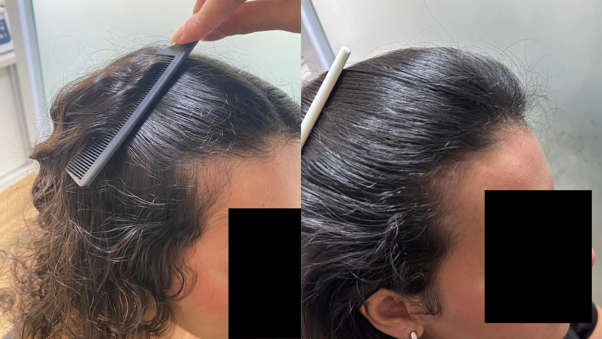 Antes e depois, caso 1