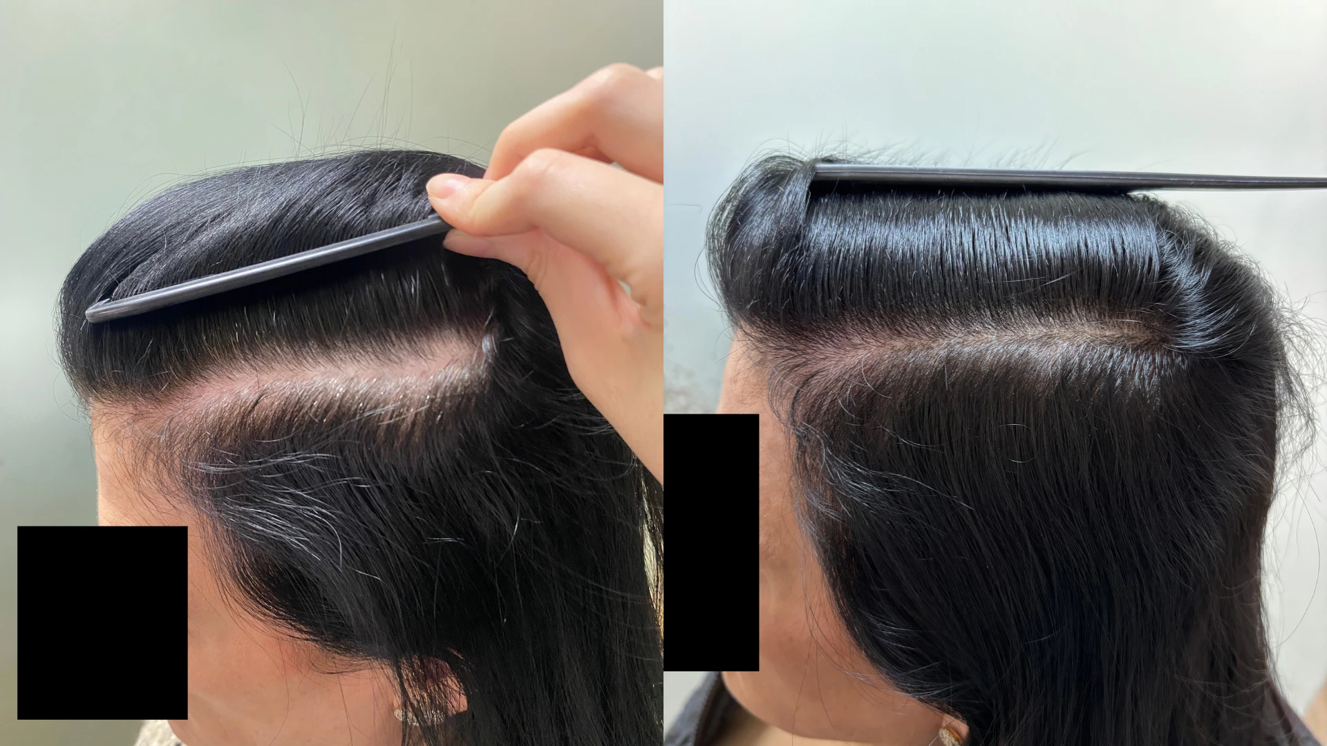 Antes e depois, caso 1