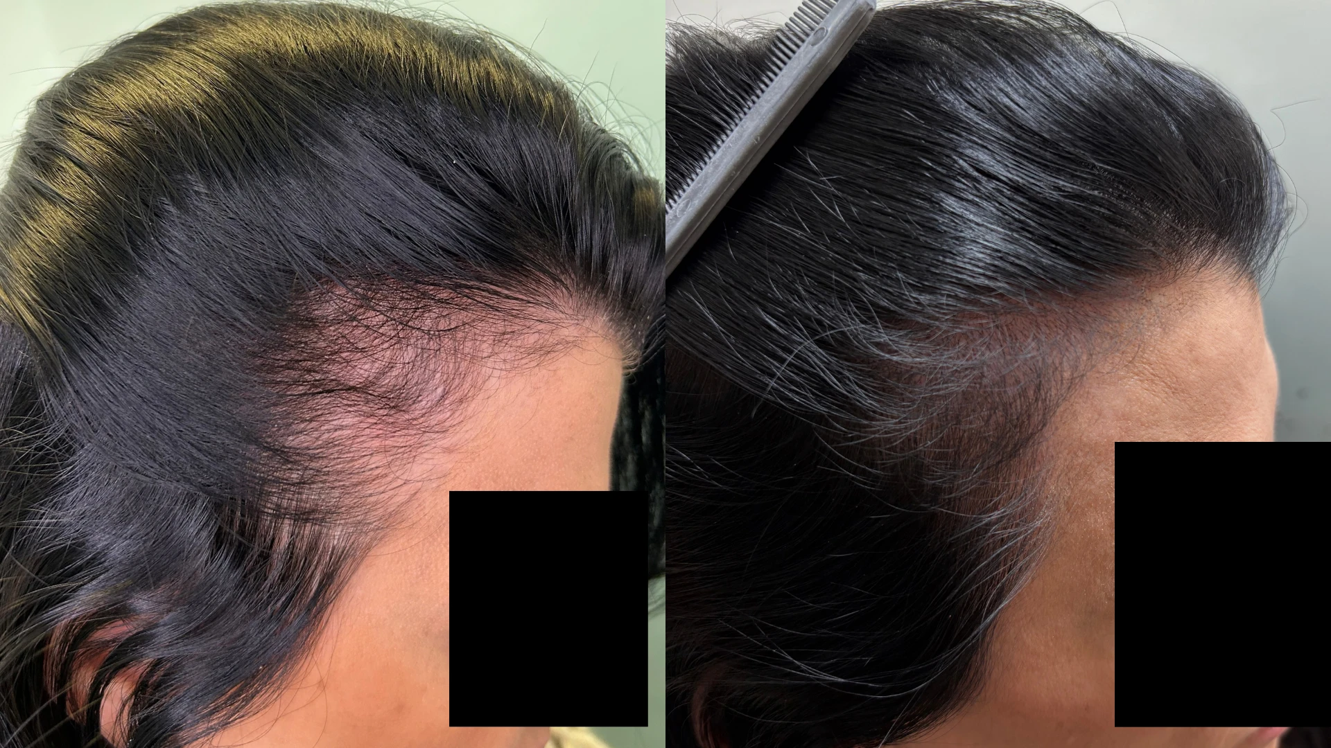 Antes e depois, caso 2