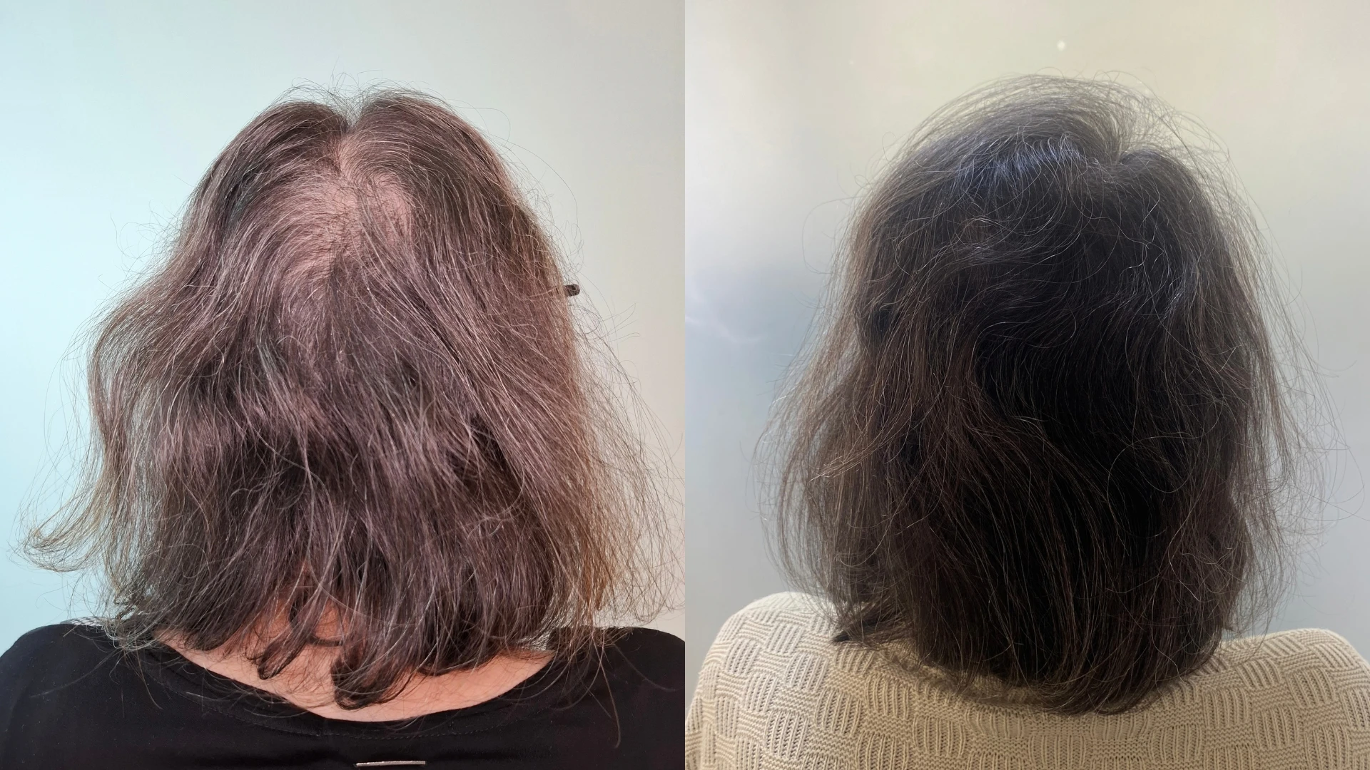 Antes e depois, caso 1