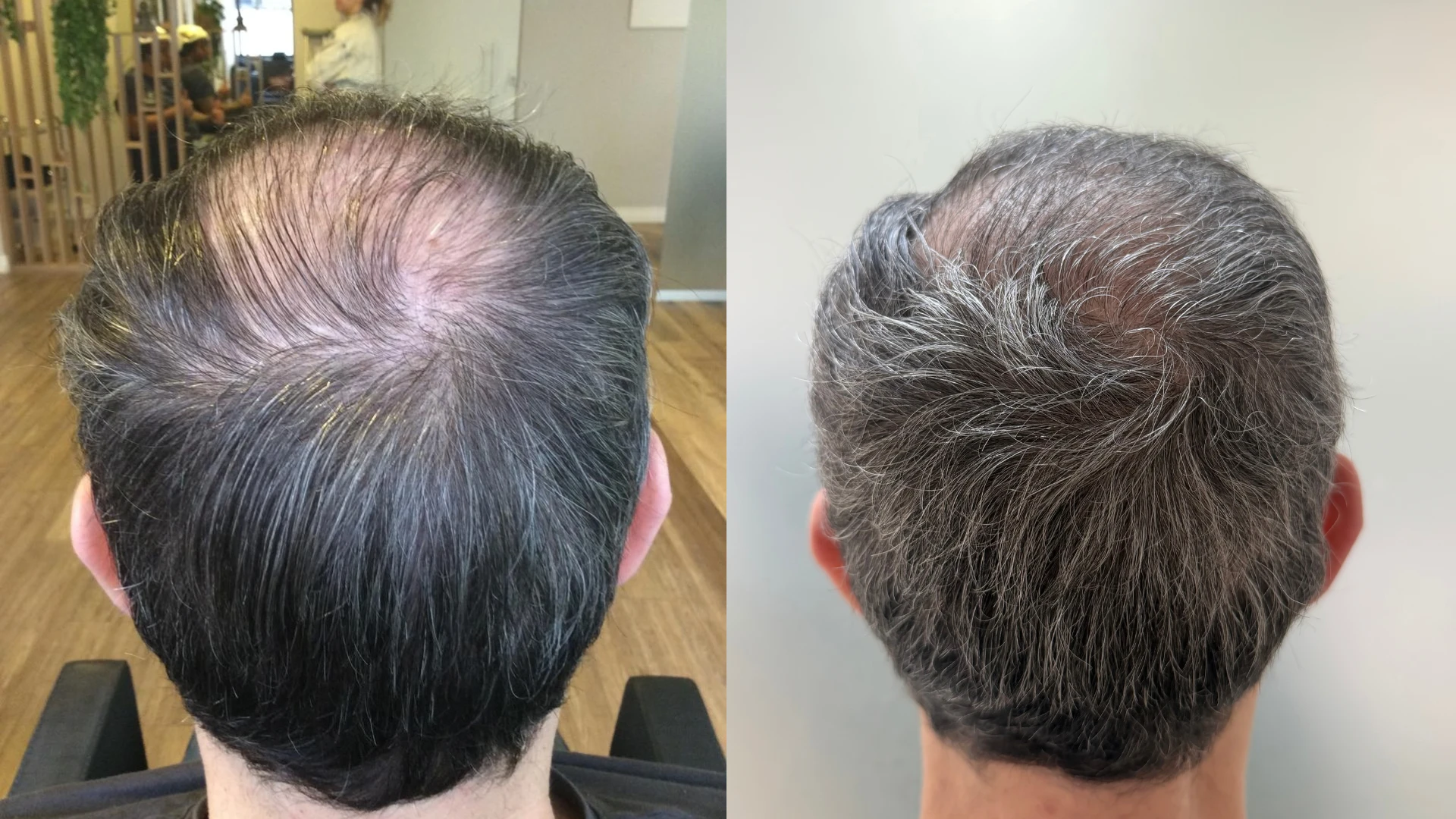 Antes e depois, caso 2